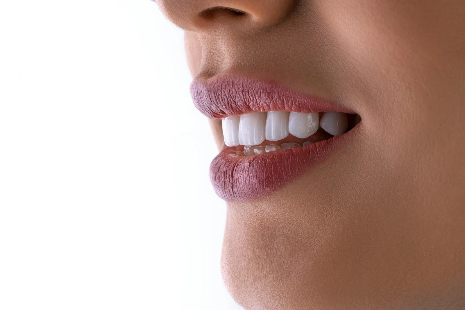 Close-up of a radiant natural smile with smooth composite bonding contours