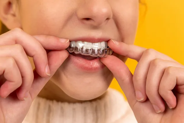 A patient smiling with straight, evenly aligned teeth after Invisalign® treatment